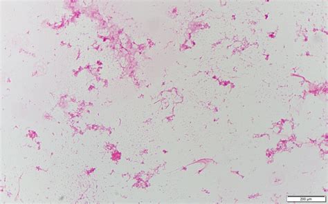 Campylobacter fetus〔中絶菌：畜産業界での別名〕 | グラム染色: Gram Stain