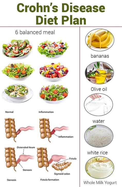 nice Crohn’s Disease Diet Plan – What Is It And How Does It Work? Check ...