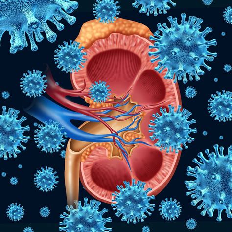 BK Virus and Quinolones — NephJC