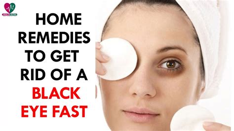 Home Remedies to Get Rid of a Black Eye Fast - Health Sutra - YouTube