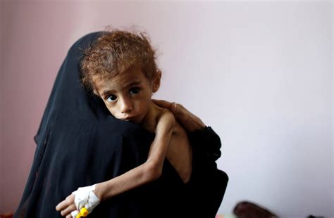 The humanitarian crisis in Yemen