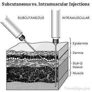 New Study: Subcutaneous Administration of Testosterone Safe, Effective Alternative to IM ...