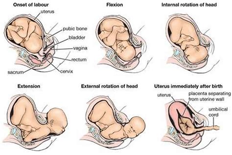 Cephalic presentation of baby in pregnancy