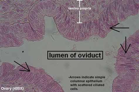 Oviduct Histology 400x