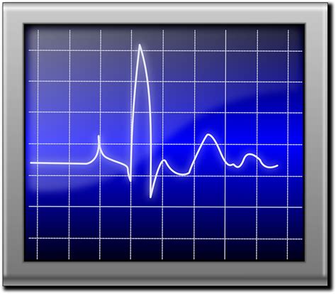 Download Pulse, Heartbeat, Pulsation. Royalty-Free Vector Graphic - Pixabay