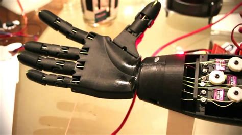 3d Printed Prosthetic Arm