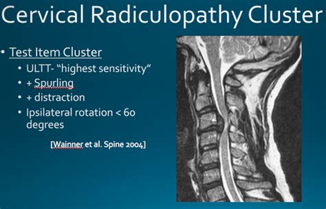 Cervical Myelopathy vs. Radiculopathy