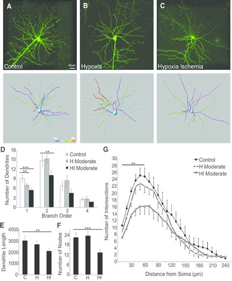 Dendrite development after neonatal HI. EGFP-labeled neurons imaged at ...