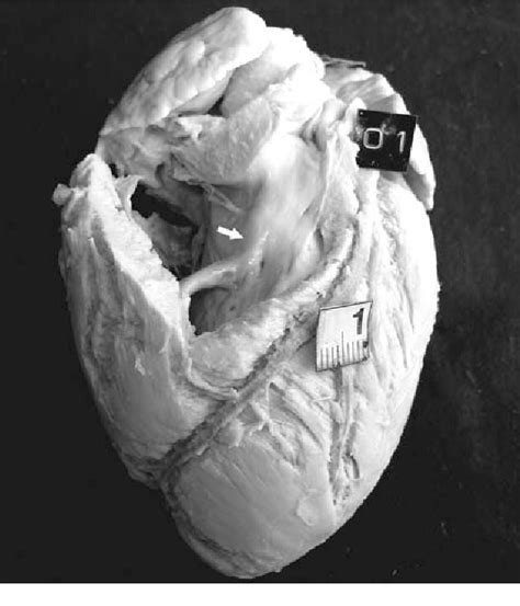 Figure 3 from Anatomy of the septomarginal trabecula in goat hearts. | Semantic Scholar