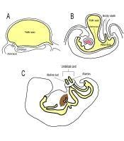 vitelline duct - meddic