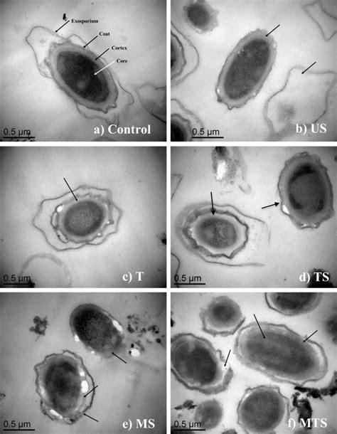 Transmission electron microscopic (TEM, 50, 000×) images of Bacillus... | Download Scientific ...