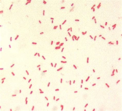 Free picture: yersinia pestis, small, gram, negative, bacillus