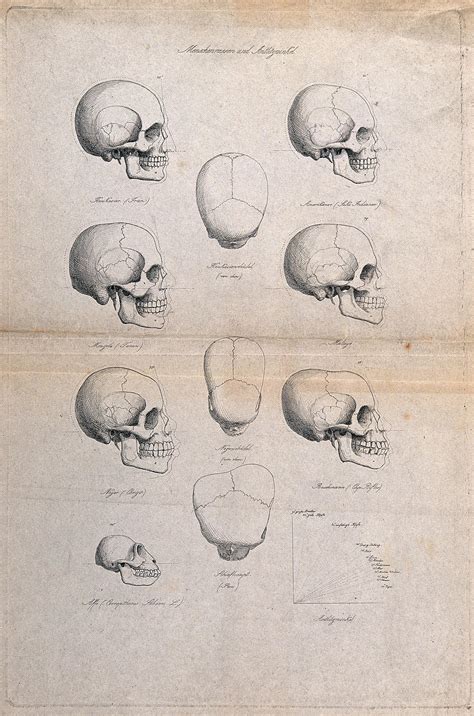 Human skulls of different racial types: eleven figures also including ...