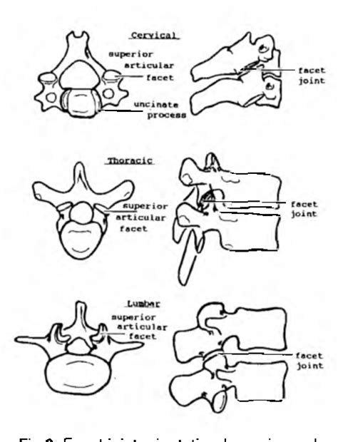 Figure 2 from THE INTERVERTEBRAL JOINTS I I : THE FACET JOINTS ...