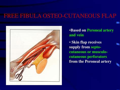 PPT - “FREE FIBULA OSTEOCUTANEOUS FLAP FOR RECONSTRUCTION OF MANDIBLE IN A RARE CASE OF ...