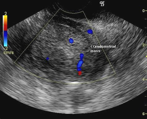 A Gallery of High-Resolution, Ultrasound, Color Doppler & 3D Images ...