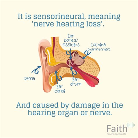 What is Sudden Sensorineural Hearing Loss/Sudden Deafness? (Slideshow) | Faith Hearing Specialists