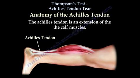 Thompson's Test Achilles Tendon Tear - Everything You Need To Know - Dr ...