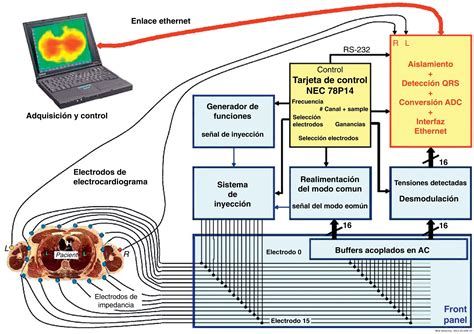 Electrical impedance tomography in acute lung injury | Medicina Intensiva