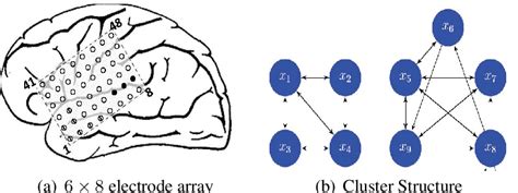 1(a) Spatial placement of ECoG electrodes on an epileptic patient. 1(b)... | Download Scientific ...