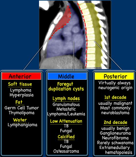 Mediastinal Tumors | Radiology, Pediatrics, Radiology imaging