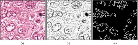 Creating the edge map. (a) Original color image; (b) smoothed red... | Download Scientific Diagram