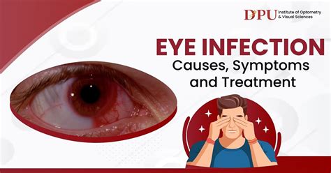 Eye Infection : Causes, Symptoms and Treatments