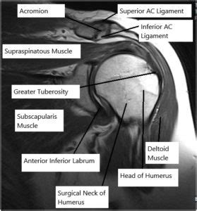 Rotator Cuff Tear New York | Shoulder Specialist