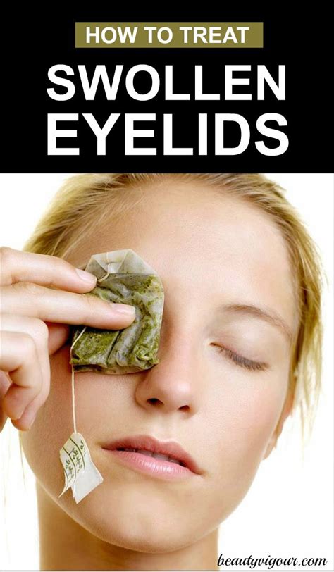 How to Treat Swollen Eyelids | Swollen eyelid, Swollen eye remedies, Swollen eyelids remedy