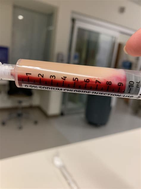 High triglycerides, pulled from a pancreatitis pt : r/nursing