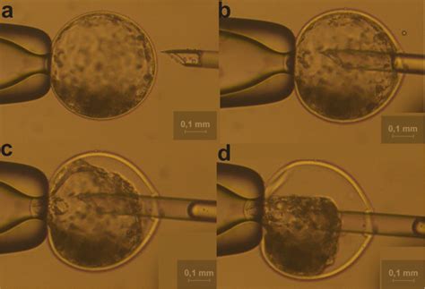 Blastocoel fluid collection of D7 expanded blastocyst (20×). a Intact ...