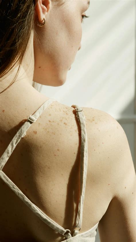 Dry Skin Patches on the Back of the Neck · Free Stock Video