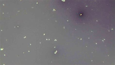 Micrograph Micrococcus luteus nigrosin negative stain 1000x p000014 ...