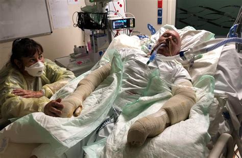 Driveway explosion leaves Canterbury man with burns like White Island victims | Otago Daily ...