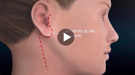 Anatomy Of The Parotid & Submandibular Glands & Ducts | Dr. Larian