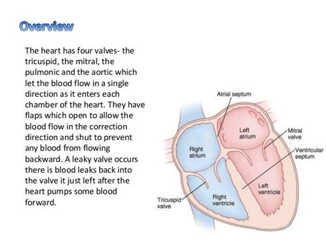 Leaky Heart Valve: Symptoms, Causes, and Treatments