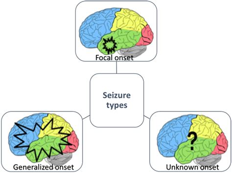 Classification of seizure types based on ILAE [13] | Download Scientific Diagram