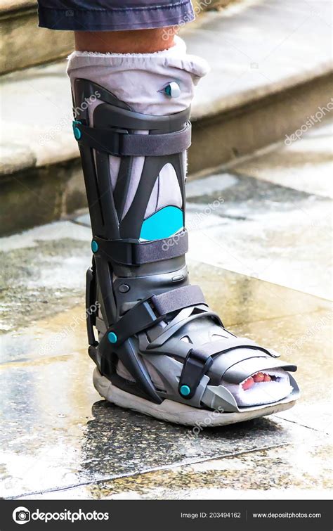 Ankle Brace Aircast Flat Foot Pttd Brace Aircast Boot Adult Stock Photo by ©Flik47 203494162