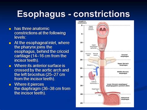 Esophagus Constriction