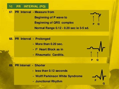 Ecg