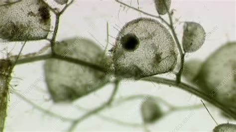 Bladderwort trap, light microscopy - Stock Video Clip - K004/5765 - Science Photo Library