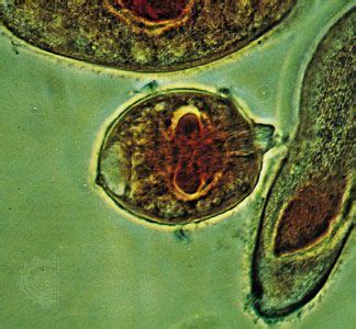 Gymnostome | protozoan order | Britannica.com