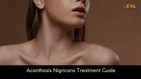 Black Neck Solutions: Acanthosis Nigricans Treatment Guide