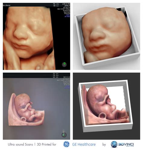 3D Printed Baby Models - 3DVinci Creations Blogs