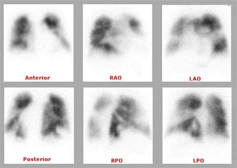 NUCLEAR MEDICINE