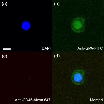 (a−d) Immunofluorescence images of an NRBC isolated from maternal... | Download Scientific Diagram