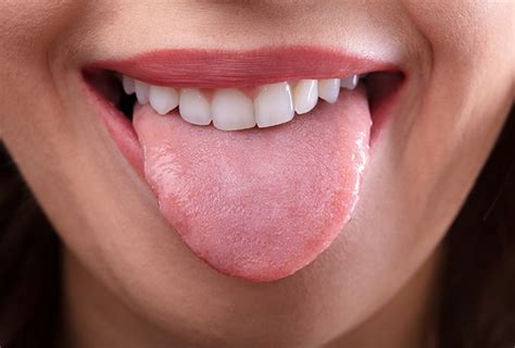 Are There Products That Help With Dry Mouth? - Dental Health Society