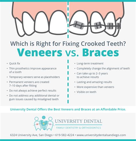 veneers-vs-braces - University Dental