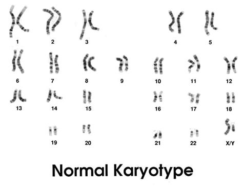 Karyotype and karyogram