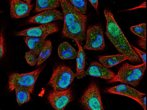 Testing Novobiocin in PARP Inhibitor-Resistant Cancers - NCI